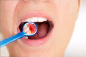 Dental Patient Suffering From Gum Disease